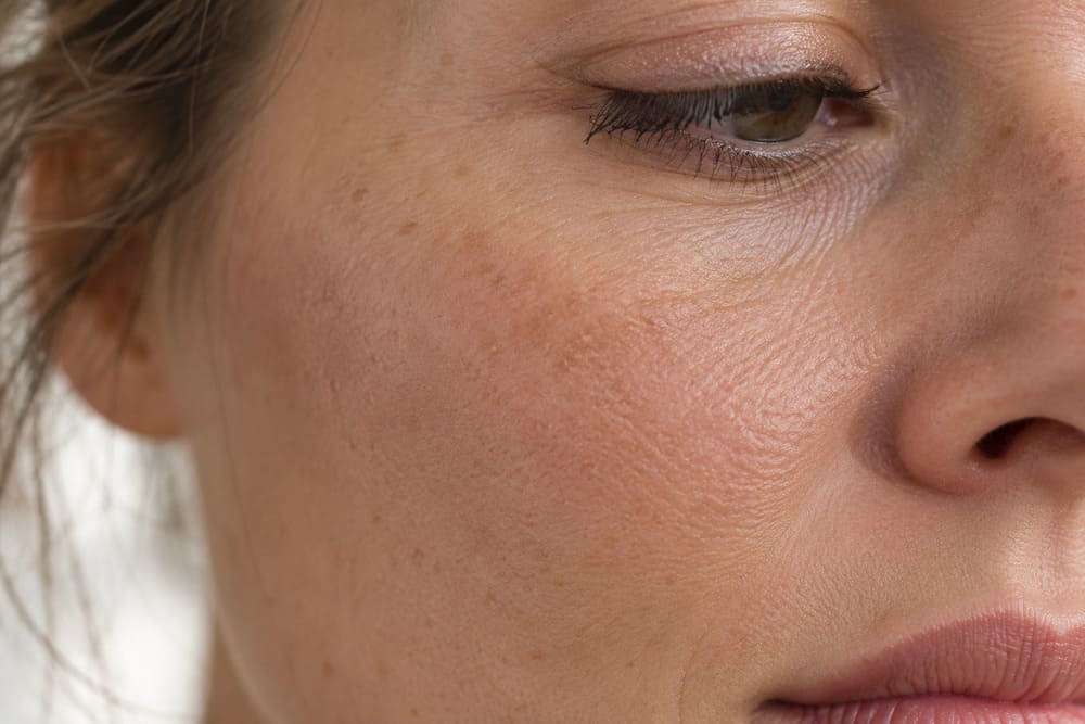 Piel sin luminosidad causas y tratamiento — centro de estética avanzada Logroño Silvia Pascual